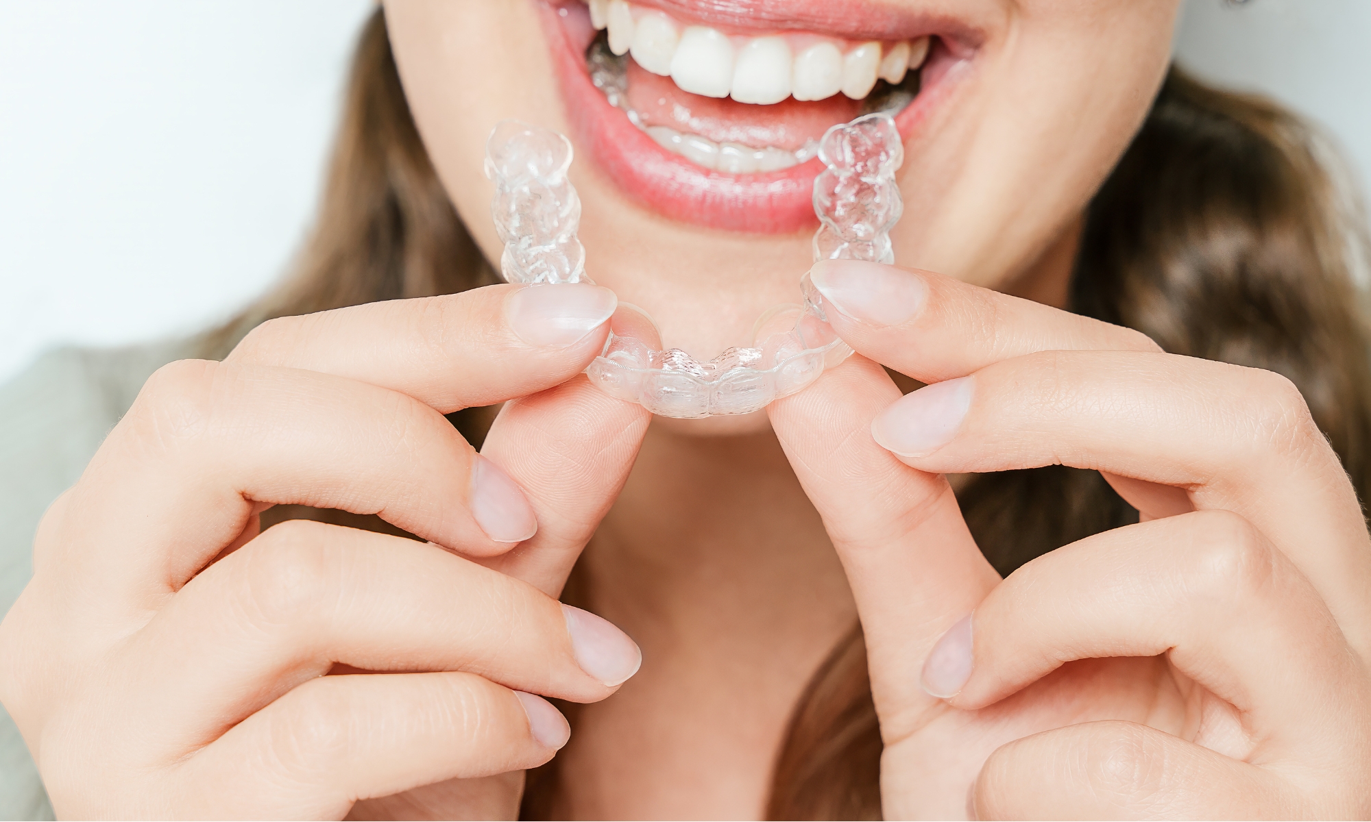 diferencia entre ortodoncia invisible y brackets