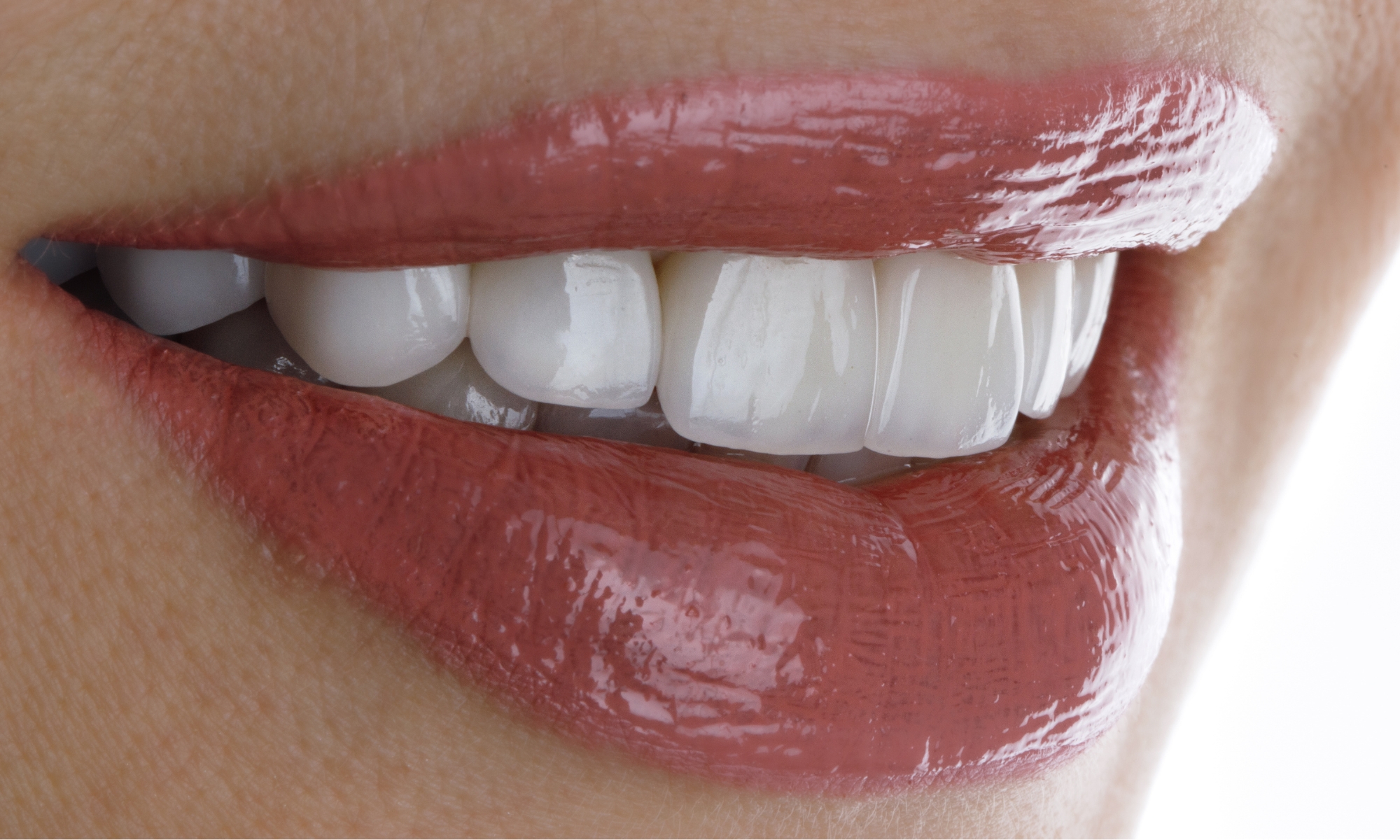 estética dental en clínica de Granada