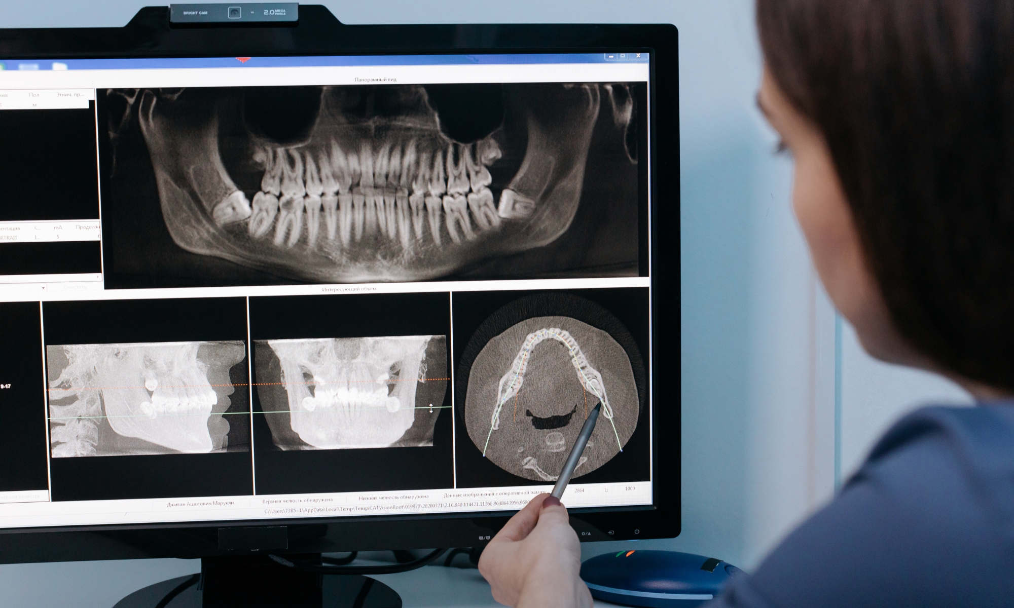 cirugía e implantología dental en Granada
