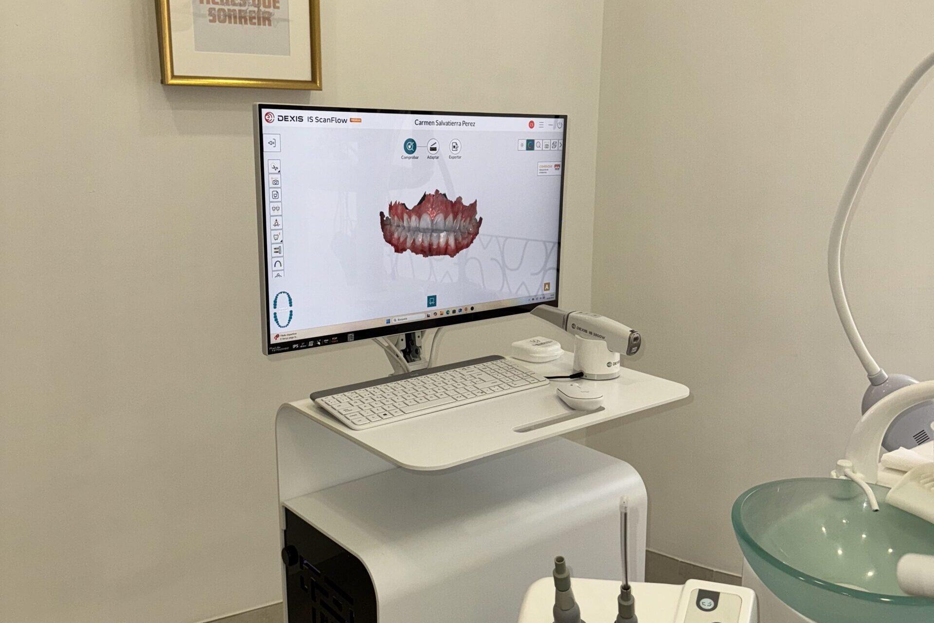 diagnóstico digital con escáner intraoral en Salvatierra Odontología
